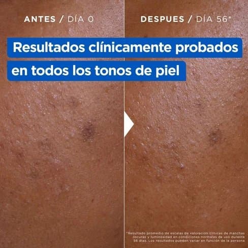✨ Mixa Niacinamide Bright ✨